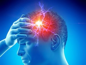 Een tekening van migraine in het hoofd van een man: Een vlammende hoofdpijn waaruit bliksemschichten door zijn hoofd gaan