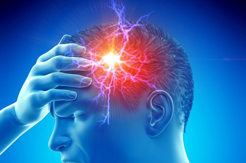 Een tekening van migraine in het hoofd van een man: Een vlammende hoofdpijn waaruit bliksemschichten door zijn hoofd gaan